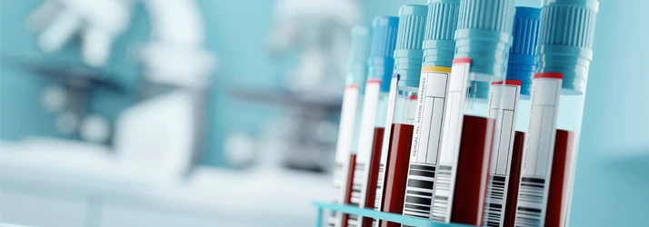 Chiropractic Gulfport MS IV Blood Test Vials